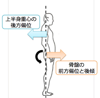 坐骨神経痛の正体 梨状筋症候群 の症状と特徴 ストレッチ法を解説