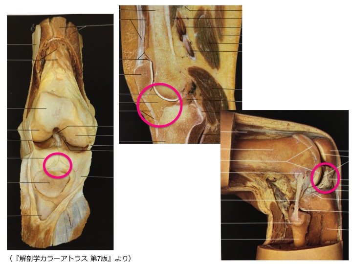 膝蓋下脂肪体の機能解剖と膝前部痛のまとめ 理学療法士が使える評価 治療